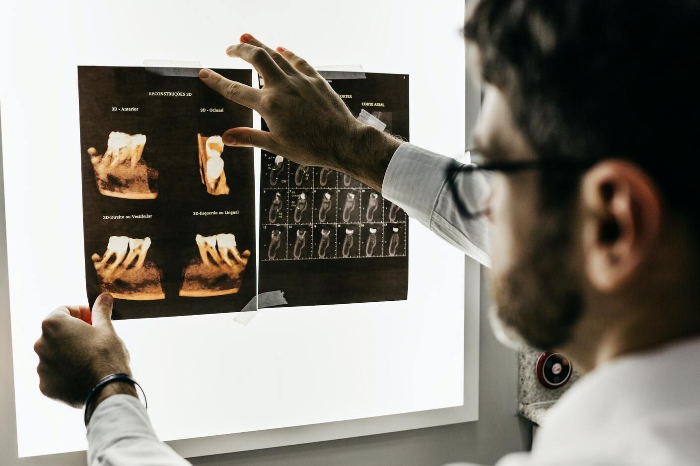 Dentist reviewing X-rays
